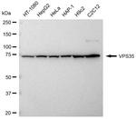 VPS35 Antibody in Western Blot (WB)