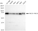 PKC delta/theta Antibody in Western Blot (WB)