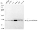 RAD51 Antibody in Western Blot (WB)