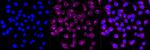 STX16 Antibody in Immunocytochemistry (ICC/IF)