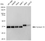 STX16 Antibody in Western Blot (WB)