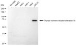 TRIP10 Antibody in Western Blot (WB)