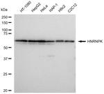 hnRNP K Antibody in Western Blot (WB)