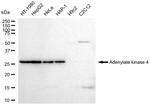 Adenylate Kinase 4 Antibody in Western Blot (WB)