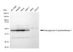 DGAT1 Antibody in Western Blot (WB)