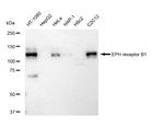 EphB1 Antibody in Western Blot (WB)