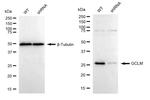 GCLM Antibody