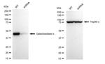 alpha Galactosidase Antibody