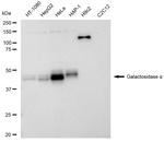 alpha Galactosidase Antibody in Western Blot (WB)