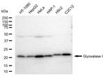 GLO1 Antibody in Western Blot (WB)