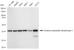 GOT1 Antibody in Western Blot (WB)