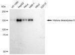 HDAC6 Antibody in Western Blot (WB)