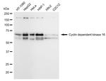 PCTAIRE1 Antibody in Western Blot (WB)