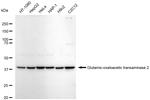 GOT2 Antibody in Western Blot (WB)