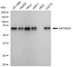 GATAD2A Antibody in Western Blot (WB)