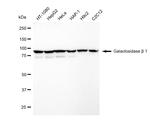 beta Galactosidase Antibody in Western Blot (WB)