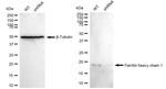 Ferritin Heavy Chain Antibody