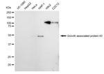 GAP43 Antibody in Western Blot (WB)