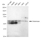 Glutaminase Antibody in Western Blot (WB)