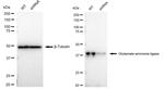 Glutamine Synthetase Antibody