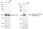 G6PD Antibody