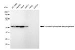 G6PD Antibody in Western Blot (WB)