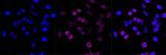 LAMP1 Antibody in Immunocytochemistry (ICC/IF)