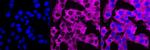 PKC alpha Antibody in Immunocytochemistry (ICC/IF)