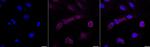 Alpha-Smooth Muscle Actin Antibody in Immunocytochemistry (ICC/IF)