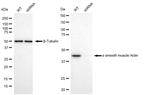 Alpha-Smooth Muscle Actin Antibody