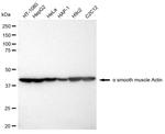 Alpha-Smooth Muscle Actin Antibody in Western Blot (WB)