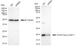 Ferritin Heavy Chain Antibody