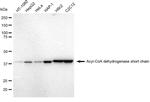 ACADS Antibody in Western Blot (WB)