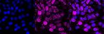 ACAT1 Antibody in Immunocytochemistry (ICC/IF)