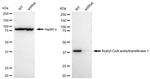 ACAT1 Antibody