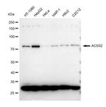 ACSS2 Antibody in Western Blot (WB)