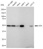 Adenosine Kinase Antibody in Western Blot (WB)