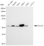 SMAD2 Antibody in Western Blot (WB)