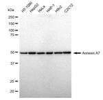 Annexin A7 Antibody in Western Blot (WB)