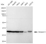 Annexin V Antibody in Western Blot (WB)