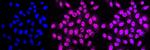 ERCC1 Antibody in Immunocytochemistry (ICC/IF)