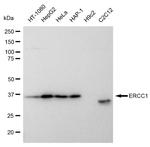 ERCC1 Antibody in Western Blot (WB)