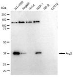 Arginase 2 Antibody in Western Blot (WB)