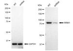 RRM1 Antibody