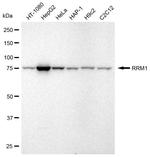 RRM1 Antibody in Western Blot (WB)