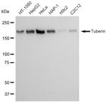 TSC2 Antibody in Western Blot (WB)