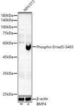 Phospho-SMAD5 (Ser465) Antibody in Western Blot (WB)