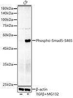 Phospho-SMAD5 (Ser465) Antibody in Western Blot (WB)