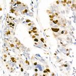 Phospho-Nucleolin (Thr76) Antibody in Immunohistochemistry (Paraffin) (IHC (P))