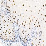 Phospho-Nucleolin (Thr76) Antibody in Immunohistochemistry (Paraffin) (IHC (P))